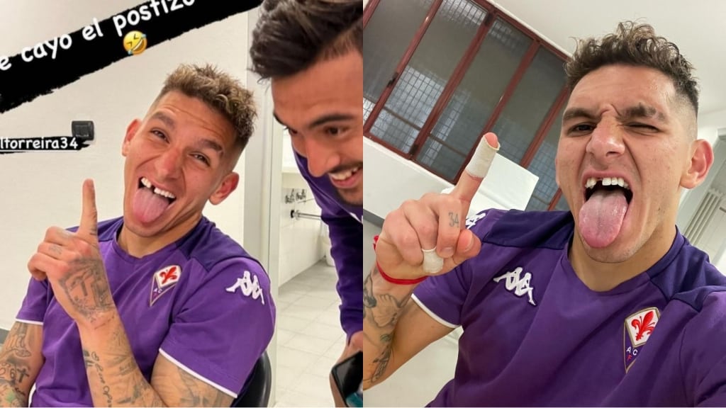 L’Arsenal prende in maniera scherzosa ed affettuosa in giro Torreira: “Occhio al buco Lucas”