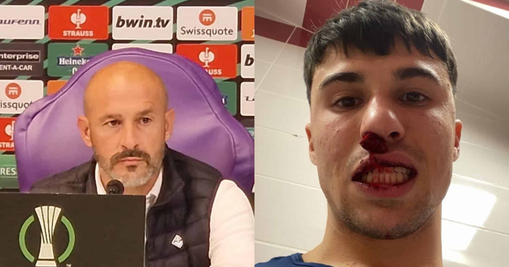 Italiano infuriato: “Bianco ha il naso rotto, è vergognoso. Colpito mentre non se lo aspettava”