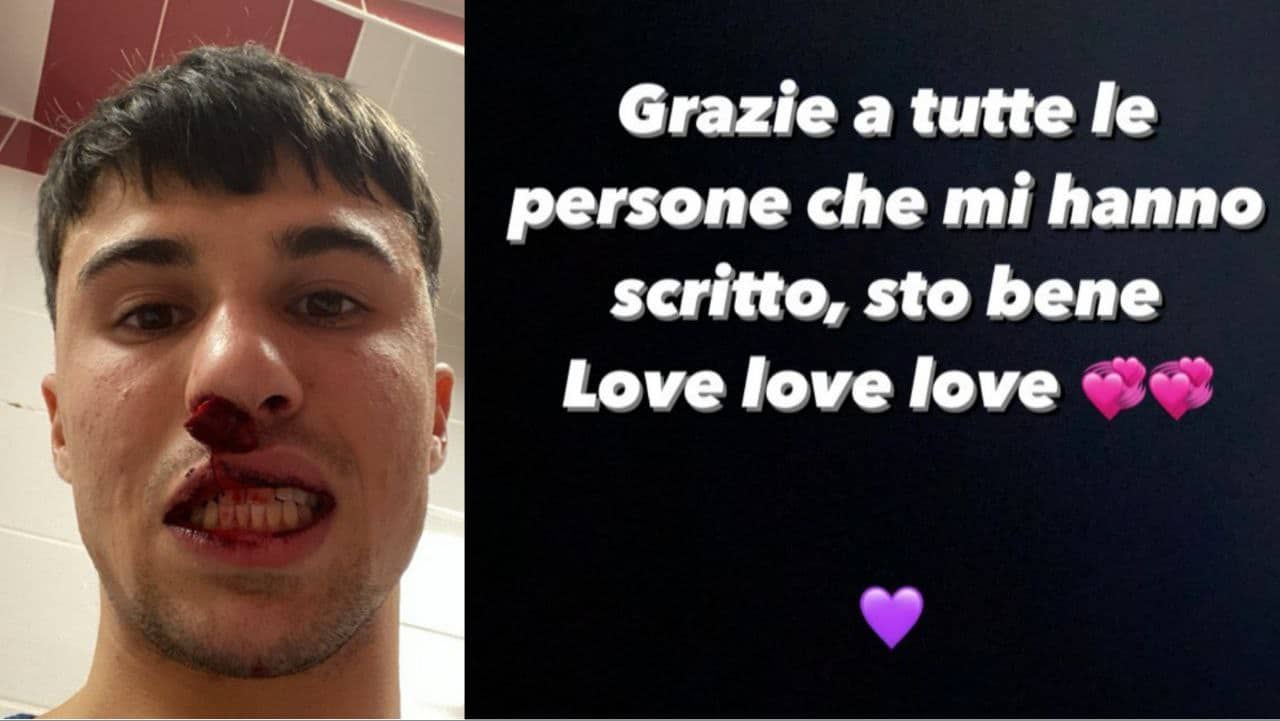 Gazzetta, Bianco aggredito, il Sivasspor rischia una maxi squalifica e l’aggressore il carcere