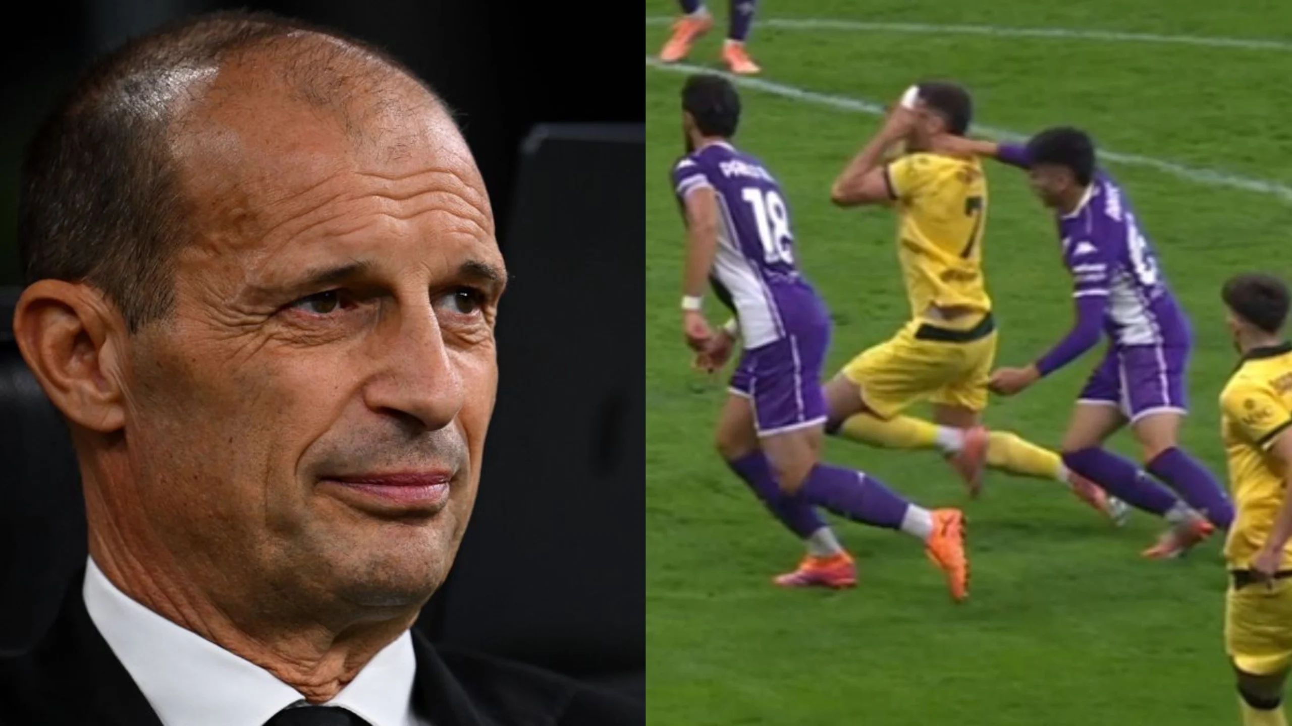 Allegri sul rigore di Gimenez: “Se ce lo danno contro ci arrabbiamo, a favore siamo contenti”