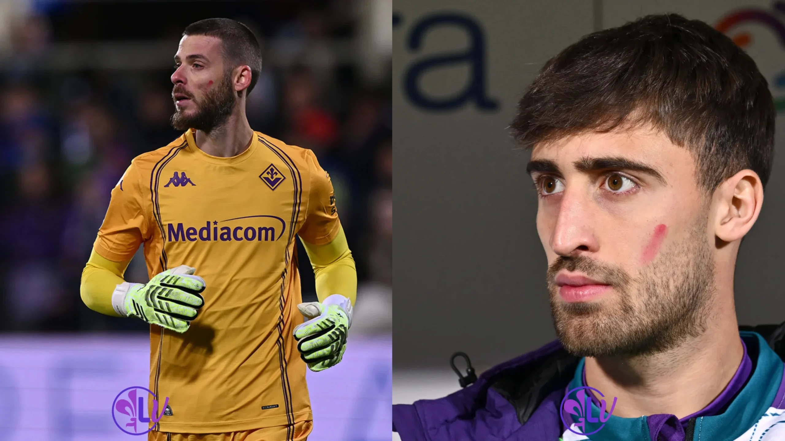 Probabile formazione Fiorentina: Si resta 3-5-2. In porta De Gea, Viti al posto di Ranieri, davanti Dzeko